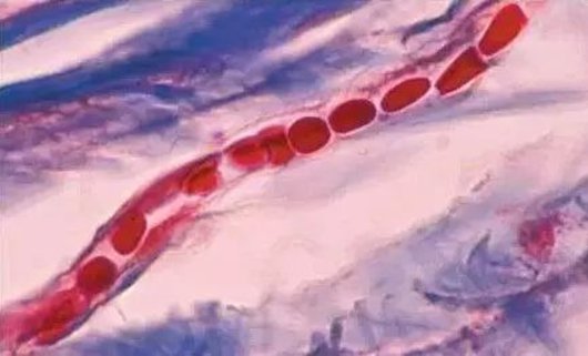 為什么久坐久站腳會(huì)發(fā)麻