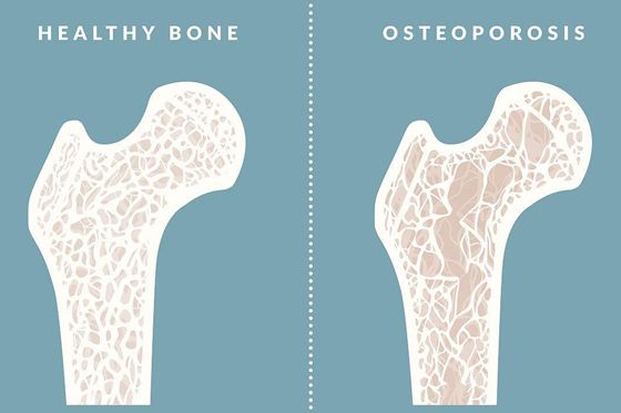 為什么人的骨頭那么硬,人的骨頭有多硬